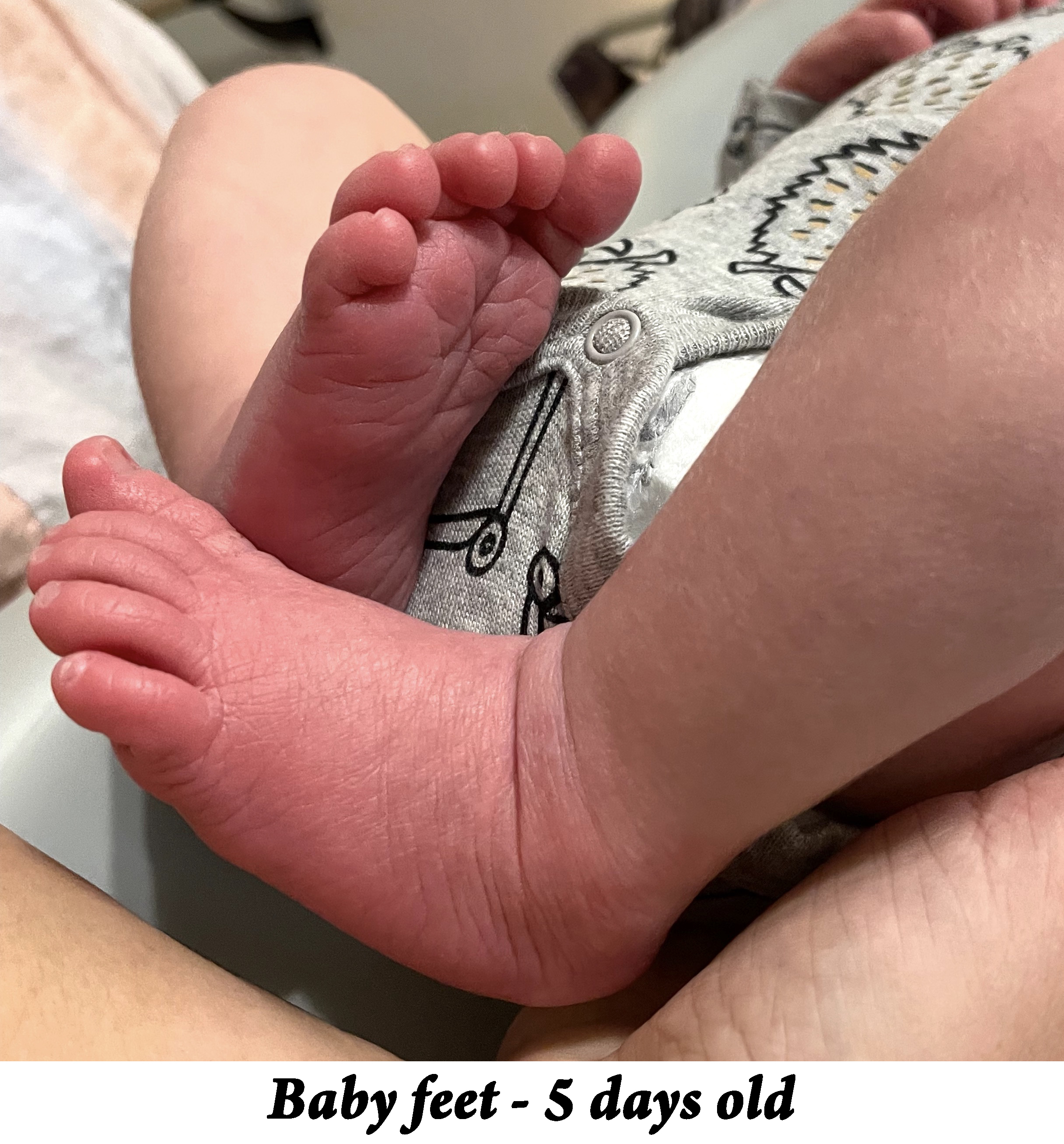 Two baby feet are seen